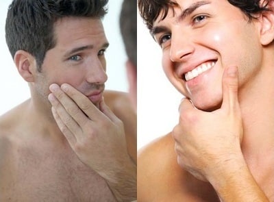 Facial Hair Removal for men