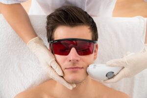 Facial Hair Removal for men with laser